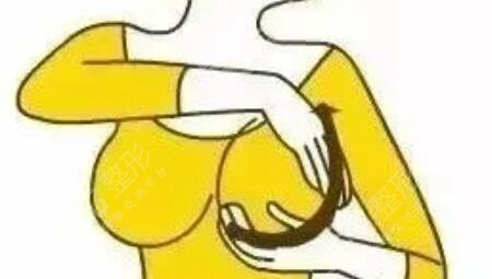 225的假体隆胸恢复好图片