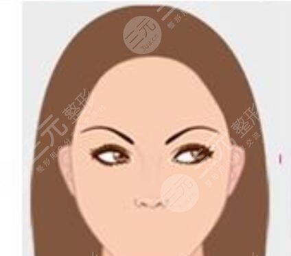 宁波美莱植发靠谱吗?附美莱发际线种植手术经历分享