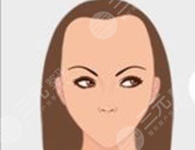 上海华美医院植发怎么样