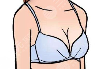 深圳科美丽格胸部整形价格表|假体隆胸真实案例分享