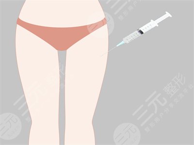上海洁铭威塑吸脂