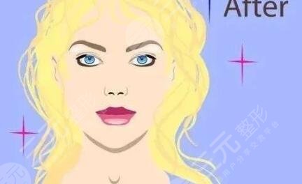 激光pm祛斑10天变化图片