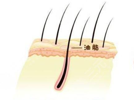 厦门新生植发医院好嘛？附女性头顶加密种植果+植头发价格表