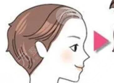 厦门新生植发医院医生简介