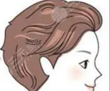 东莞美立方植发中心怎么样？附李德杨医生发际线改良4个月果