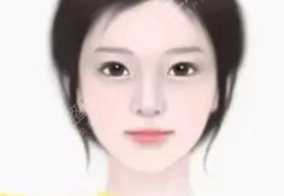 年前做的大腿吸脂塑型，现在有点后悔做腰部的吸脂