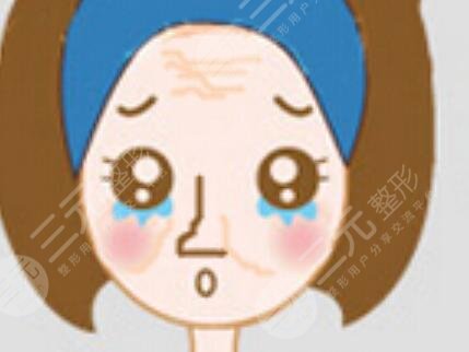 玻尿酸打山根果图