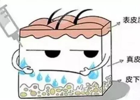 玻尿酸打山根果图