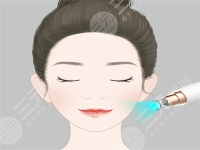 西京医院整形美容科激光去痣案例，附全新价格表~