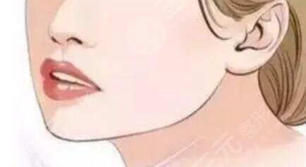 下颌角削骨手术原理