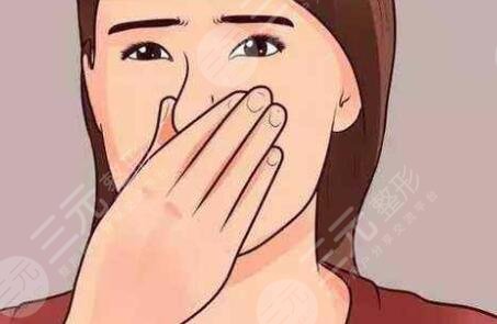 肋骨隆鼻手术之后30天