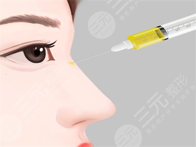 鼻子医生王志坚案例参考：给医生技术疯狂打call~
