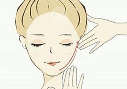 颊脂垫去除前后对比照片