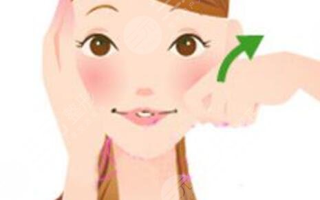 面部吸脂恢复过程