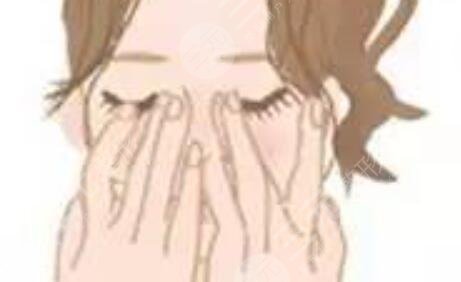 隆鼻整形手术之后