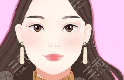 双眼皮术后20天