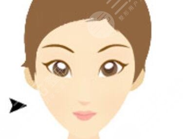 双下巴抽脂术案例术前