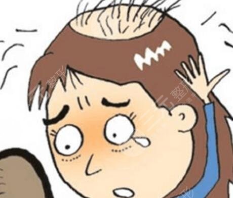 植发后十天图:短短10天能恢复到什么程度?真人展示