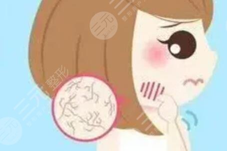 湖南省人民医院李高峰点阵激光祛斑案例，真实术后案例~