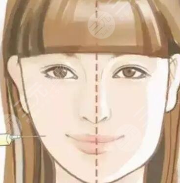 北京八大处滕利医生双眼皮