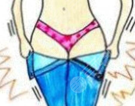 抽脂吸脂果:恢复过程