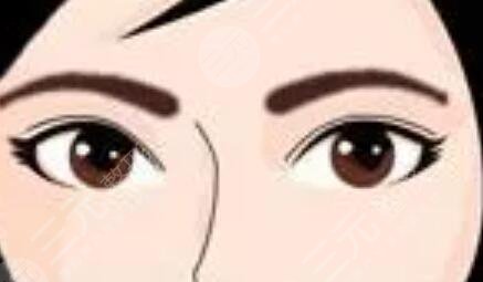 激光洗眉一到七天变化很明X！告别过时，做漂亮美眉！