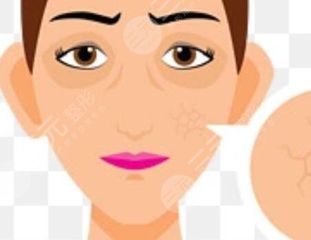 光子嫩肤去雀斑后悔了