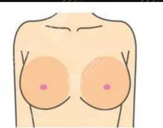 丰胸前后的图片对比