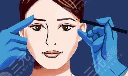 双眼皮手术之前