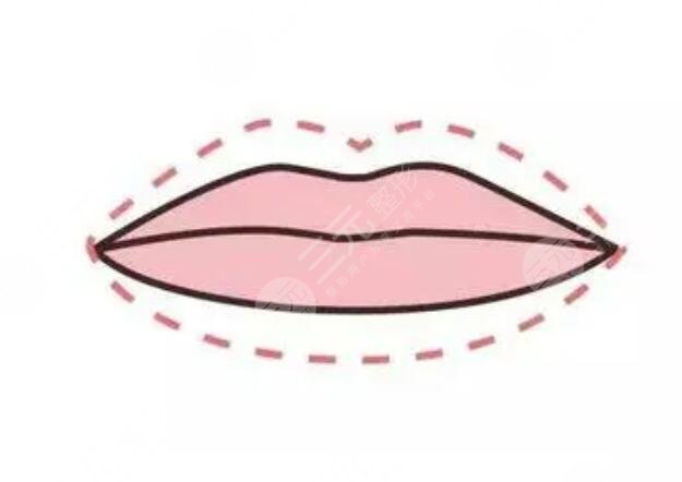 薄嘴唇打玻尿酸后果对比图展示，让嘴唇变得更性感！
