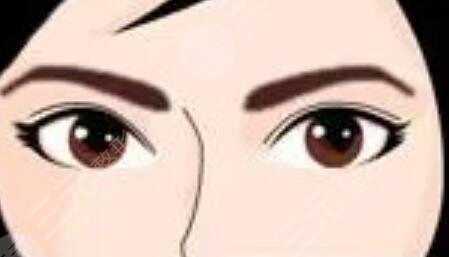 案例：绣眉后1至7天的变化图，让你拥有漂亮眉形！