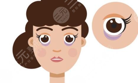 外切眼袋7天恢复图