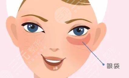 打完泪沟恢复过程图片：真人展示填充泪沟的区别~