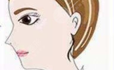 上海卢建做鼻子案例记录：术前准备、手术过程、隆鼻果一一展现~