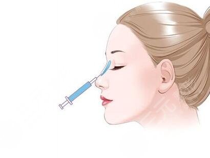 上海卢建做鼻子术前