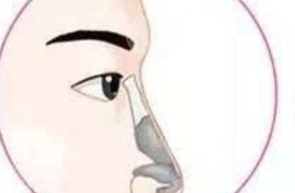 隆鼻手术之前