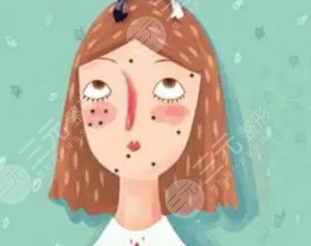 激光去痘印图片对比