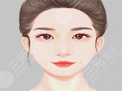 芭比双眼皮多项整形前后图