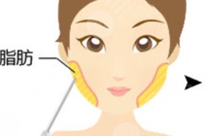 颅耳角在30°-60°之间整形手术术前