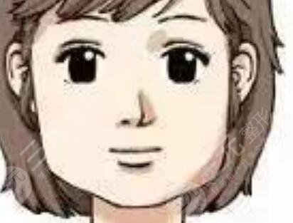 河东镐给我做的下颌角6个月了，朋友看了直呼“小天仙”！