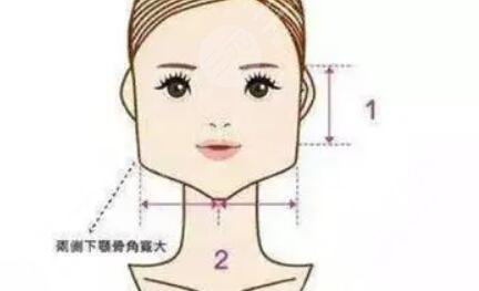 河东镐给我做的下颌角之前