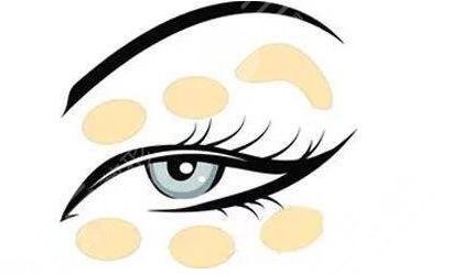 广东省第二人民医院真人双眼皮前