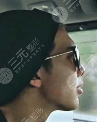 BTS金南俊颜值如何?