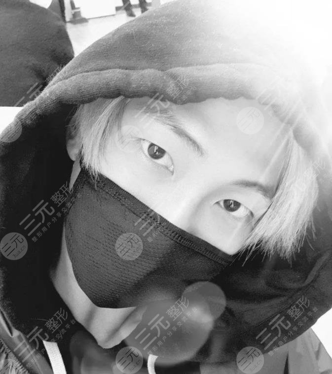 BTS金南俊颜值如何?