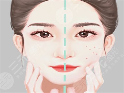 听说“颅耳角在30°-60°之间”火爆全网？说说我做颅耳角在30°-60°之间注射整形的感受吧~