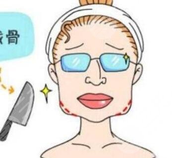 下颌角不对称真实案例