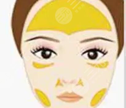 上海九院热玛吉案例