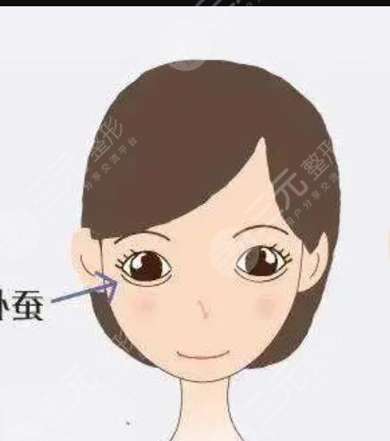 北京八大处郭鑫大夫内路去眼袋术后3个月果反馈公布~