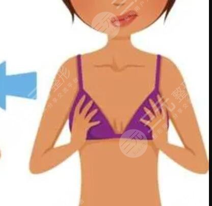 c罩杯胸部整形案例分享