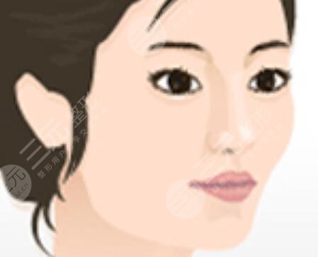 中国医大一院整形美容科怎么样？正规吗？丨黄威医生整形案例~